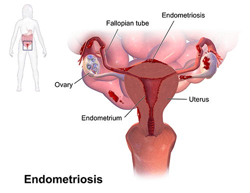 gynaecologist & laparoscopic surgeon in kolkata